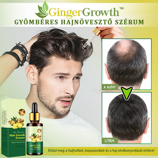 GingerGrowth™ Gyömbéres Hajnövesztő Szérum