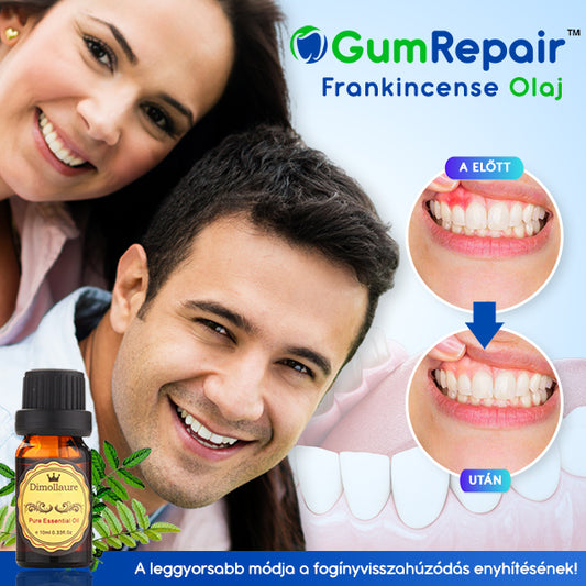 GumRepair™ Frankincense Olaj